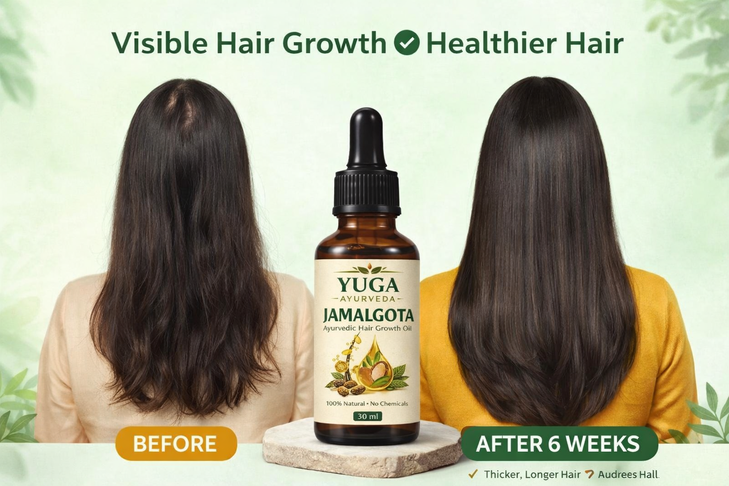 YUGA AYURVEDA Jamalgota Hair Growth Oil | Ayurvedic Hairs Growth Oil | With Amla, Yastimadhu, Camphor, Rosemary, Jatamansi & Bhringraj - 30ml