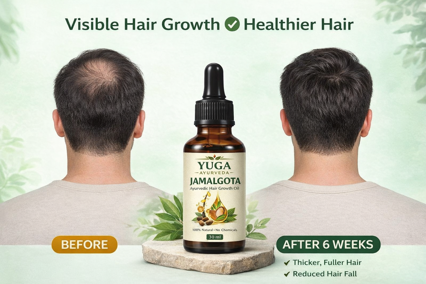 YUGA AYURVEDA Jamalgota Hair Growth Oil | Ayurvedic Hairs Growth Oil | With Amla, Yastimadhu, Camphor, Rosemary, Jatamansi & Bhringraj - 30ml