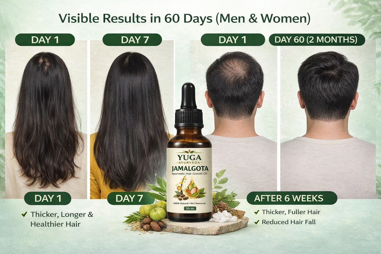 YUGA AYURVEDA Jamalgota Hair Growth Oil | Ayurvedic Hairs Growth Oil | With Amla, Yastimadhu, Camphor, Rosemary, Jatamansi & Bhringraj - 30ml